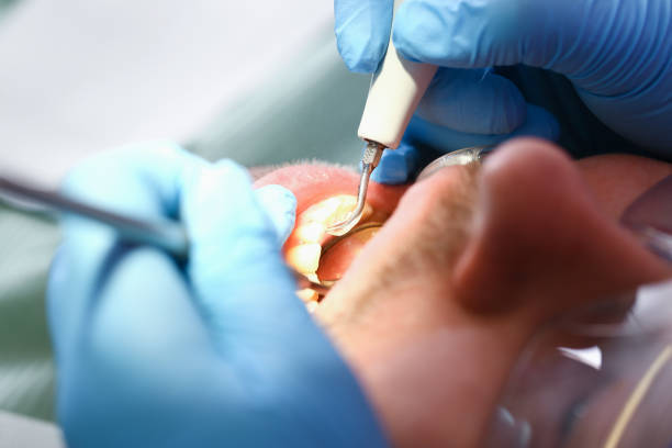Best Emergency Dental Services for Seniors in Agua Dulce, TX