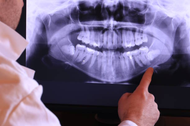 Best Emergency Dental Extractions in Agua Dulce, TX